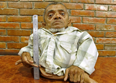 尼泊爾&ldquo;世界最矮的人&rdquo;的生活